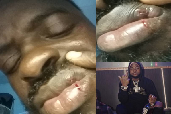 Davido Wanted in The Gambia After Shattering Photographer’s Skull and Lips