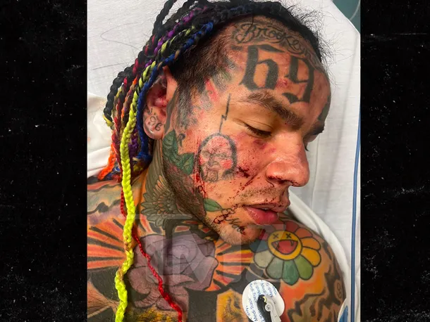 Tekashi 6ix9ine Hospitalized After Being Assaulted At The Gym 